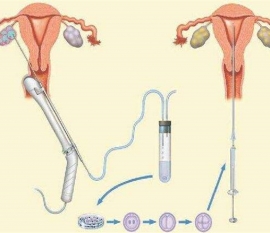 35岁女性备孕请做好以下检查，“健康苏州代生宝宝”跑不远